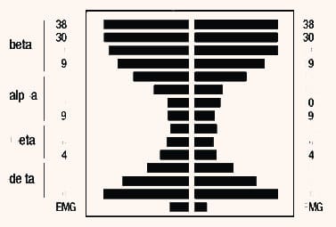 brainwaves Mind Mirror display the ordinary mind